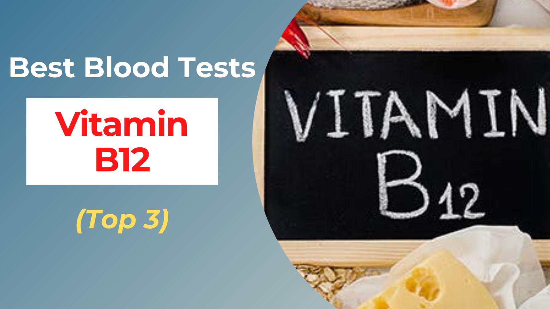 Vitamin B12 Deficiency Blood Tests