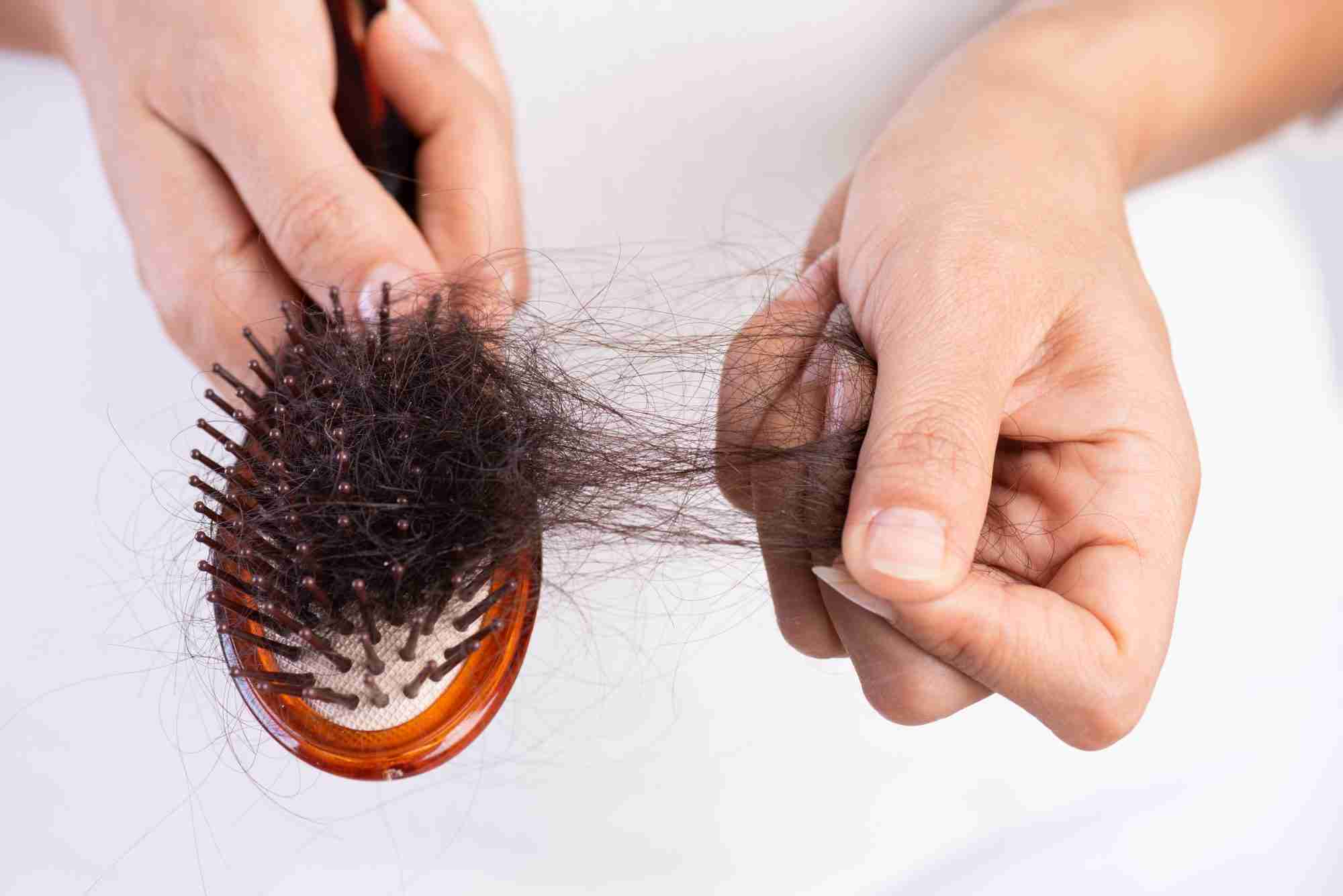 hair loss