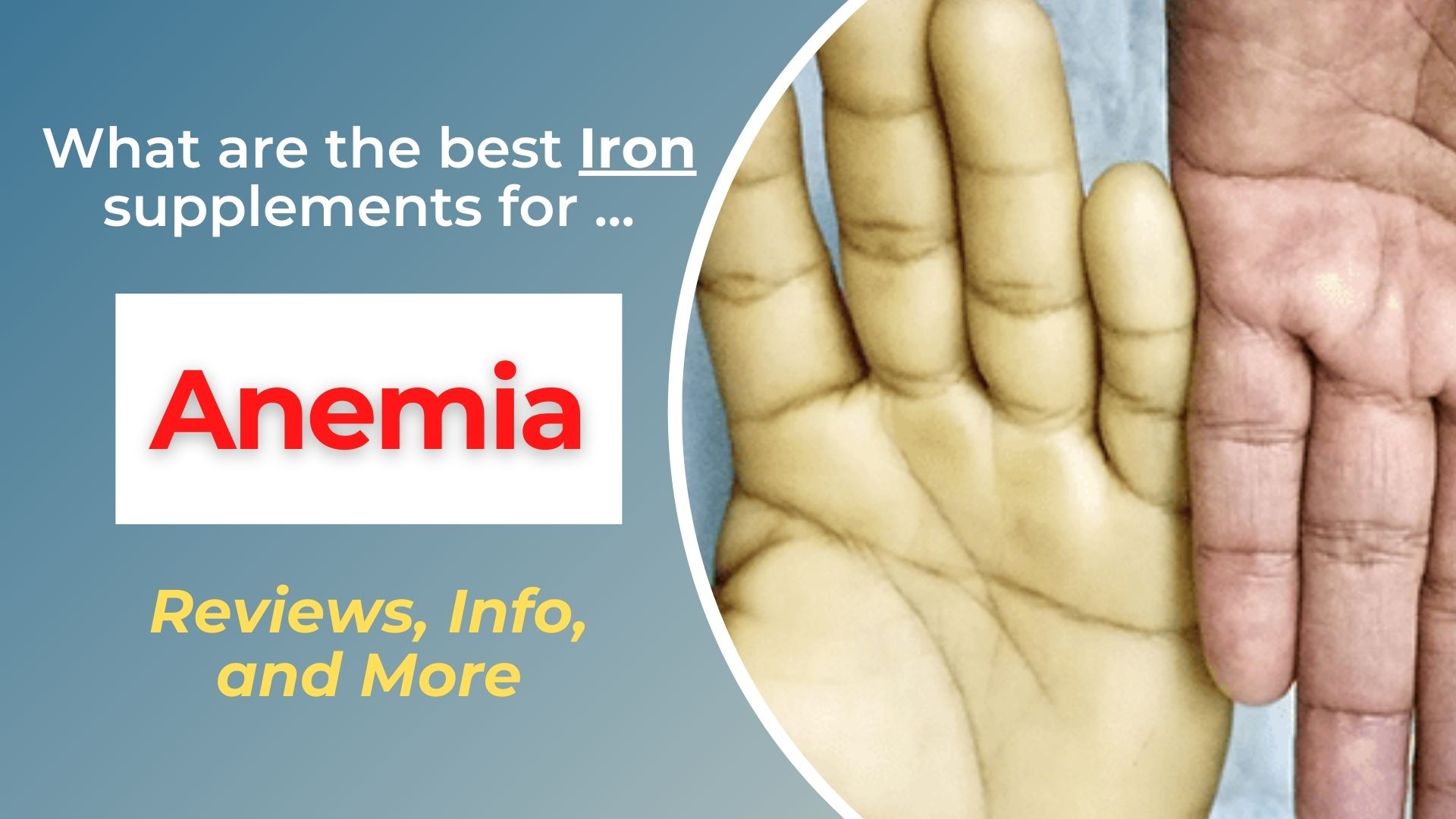Best Iron Supplements for Anemia (1)