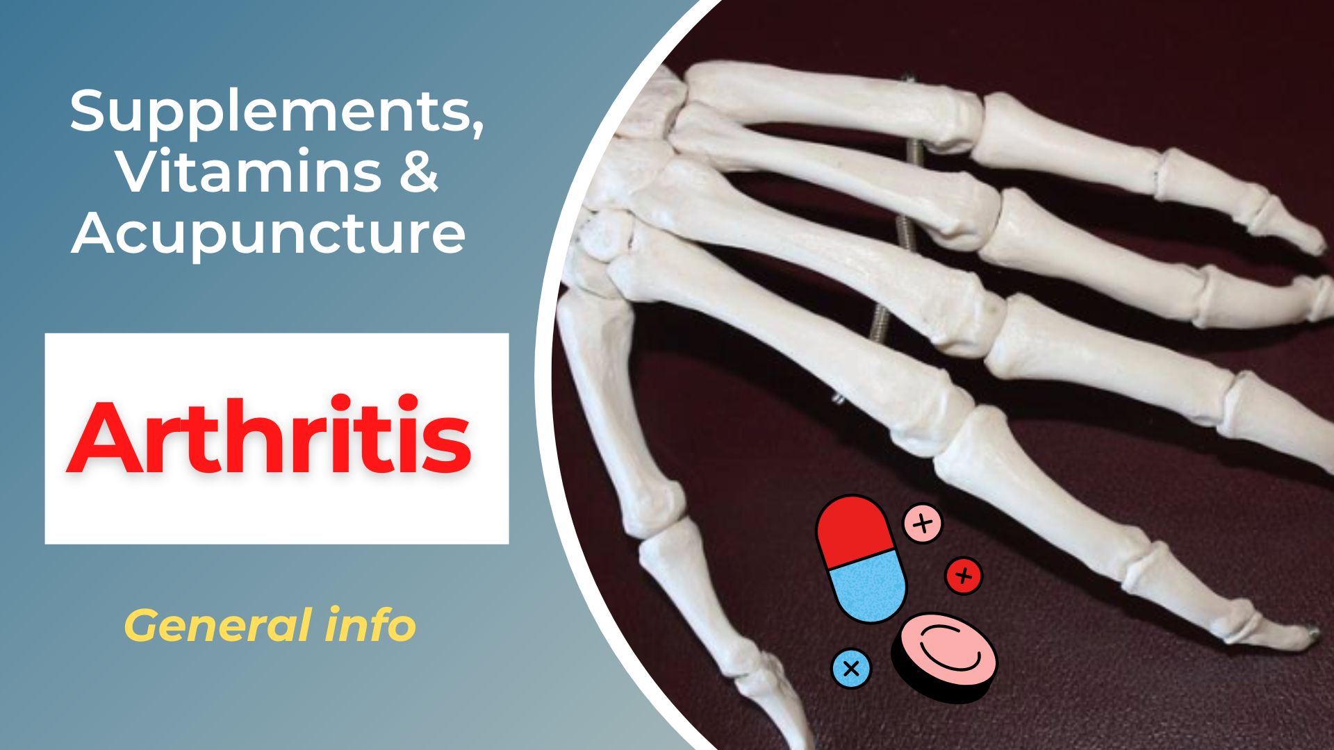 arthritis supplements