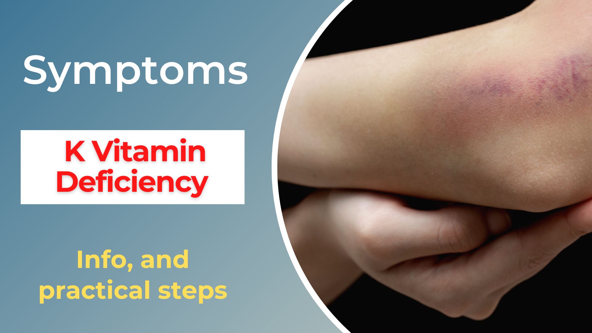 K Vitamin Deficiency Symptoms