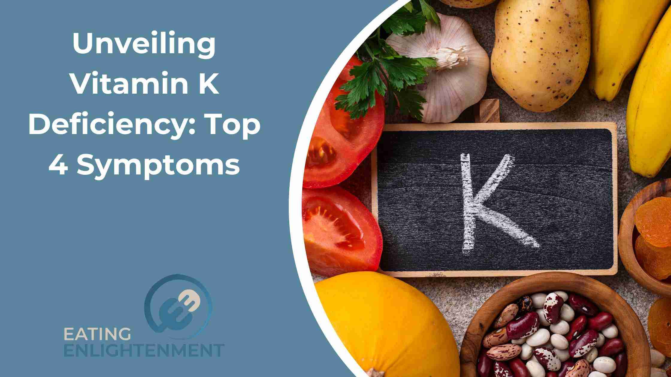 Unveiling Vitamin K Deficiency: Top 4 Symptoms