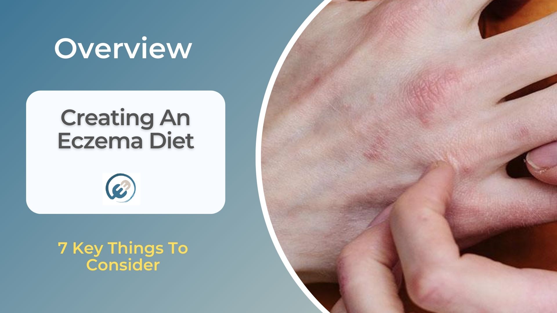 Creating An Eczema Diet