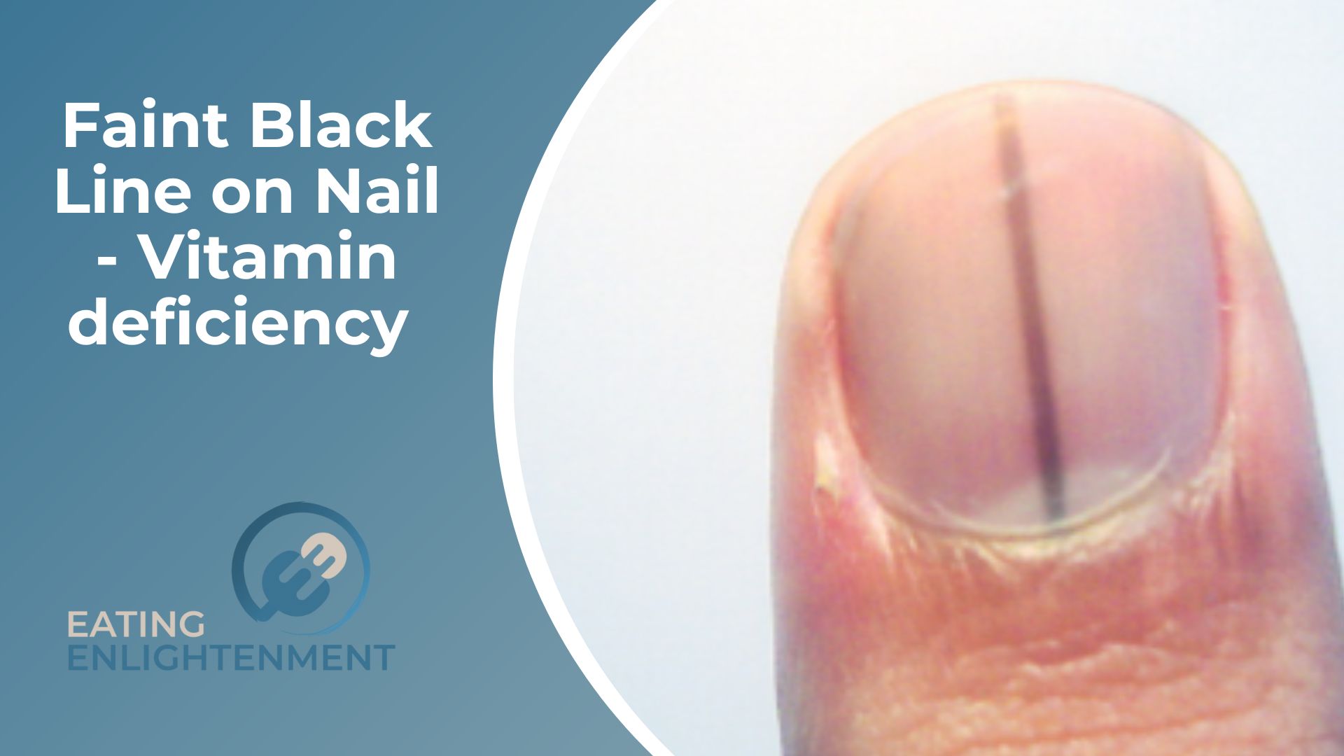 What causes dark skin around fingernails?