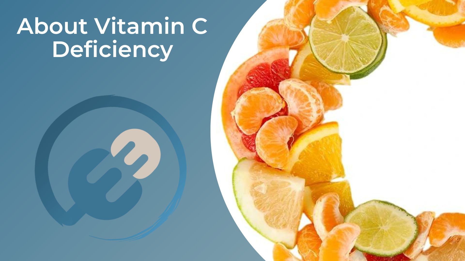 About Vitamin C Deficiency