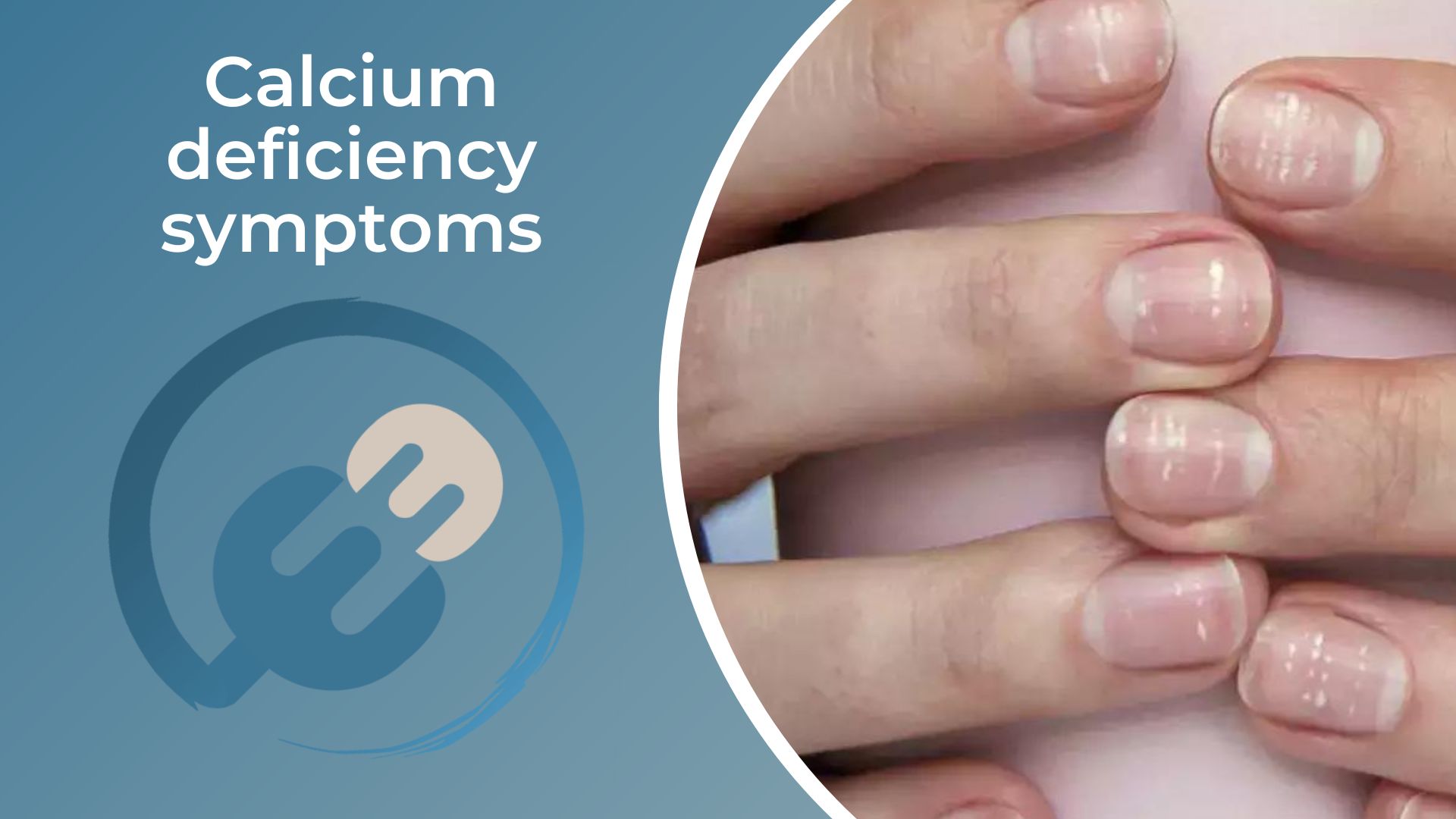 What deficiency causes white spots on nails? | The Indian Express