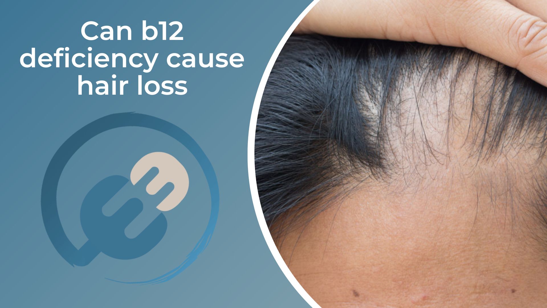 Can b12 deficiency cause hair loss