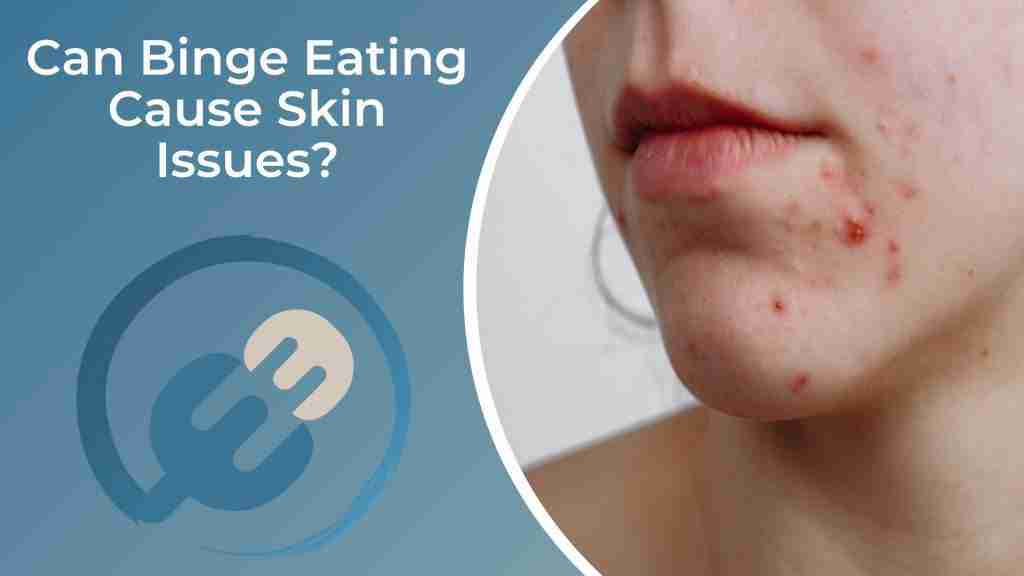 Can Binge Eating Cause Skin Issues? — Eating Enlightenment