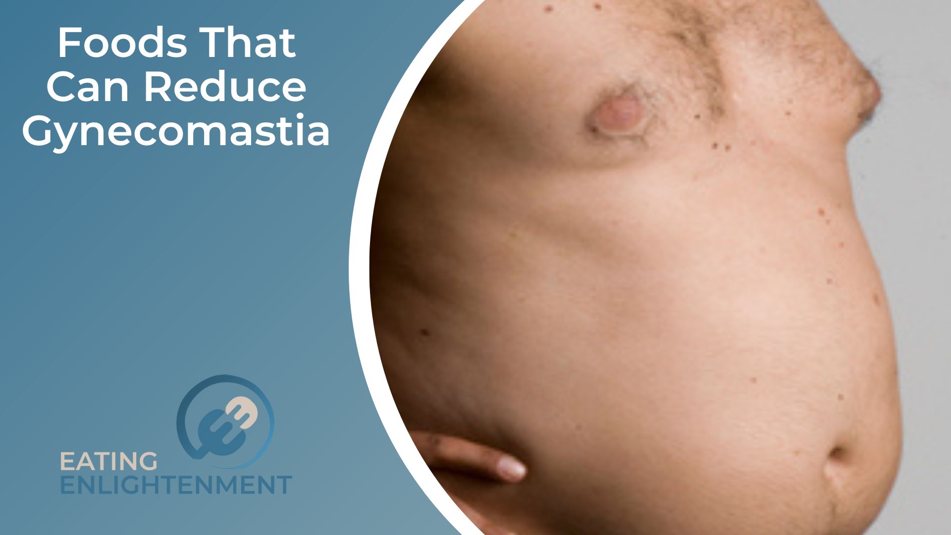 Foods That Can Reduce Gynecomastia