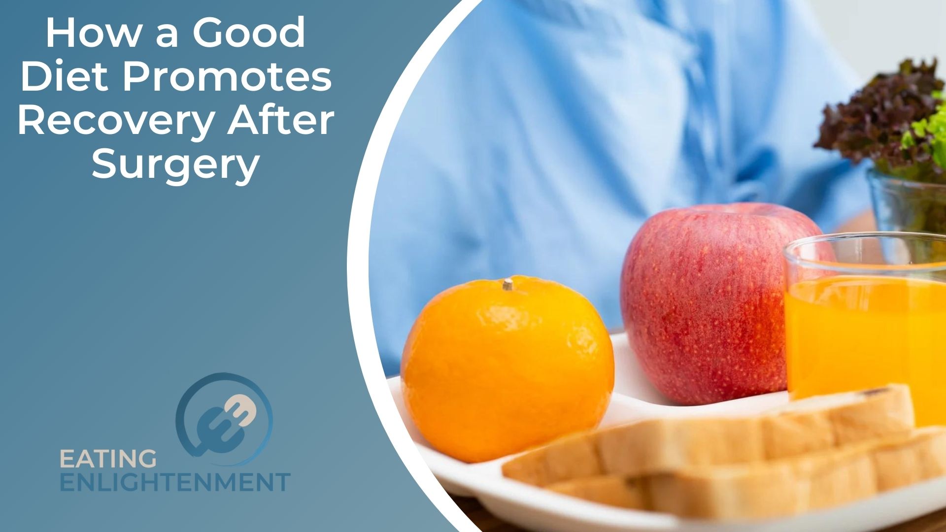 How a Good Diet Promotes Recovery After Surgery