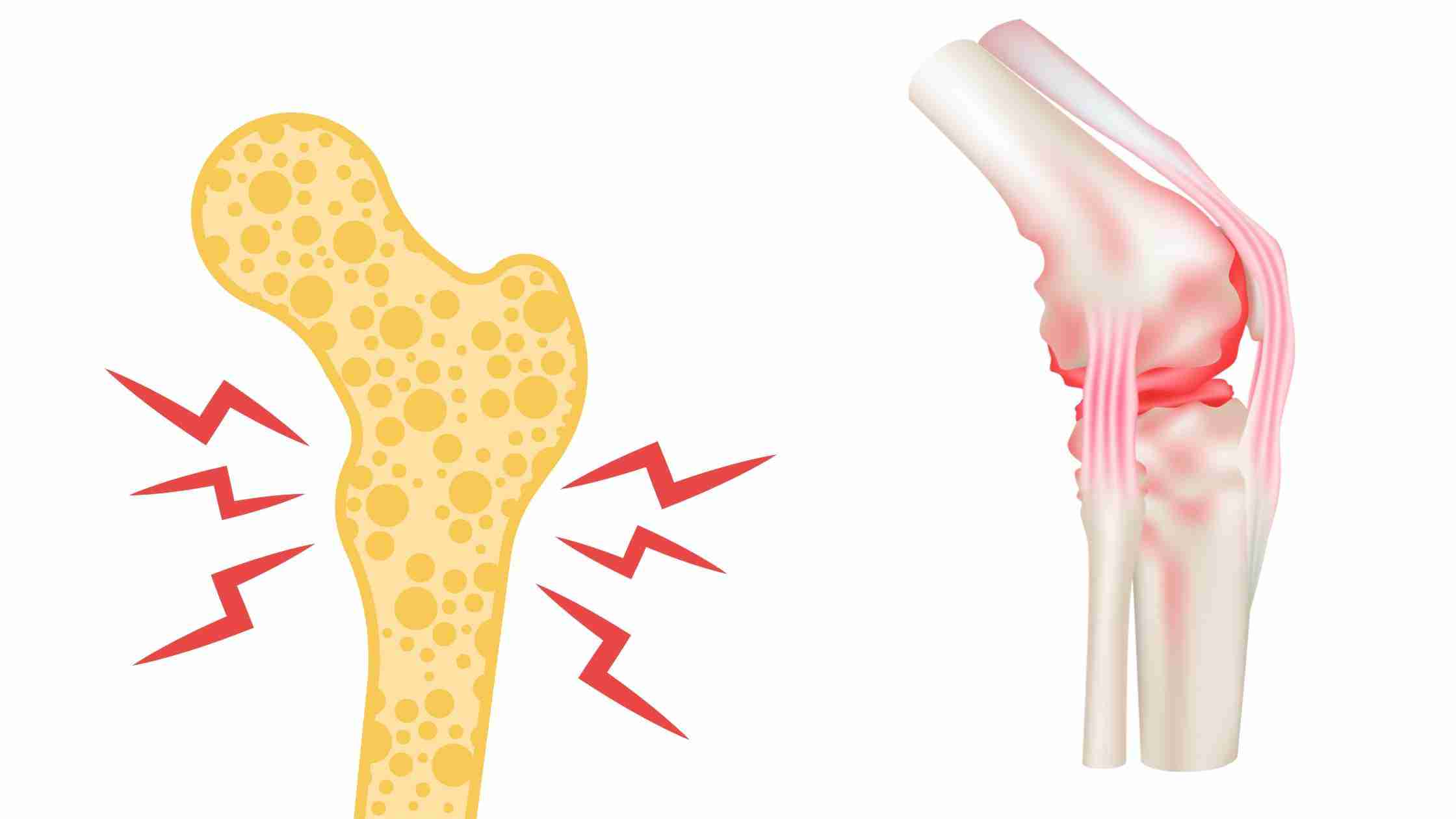 Sunshine Vitamin: The Health Benefits of Vitamin D