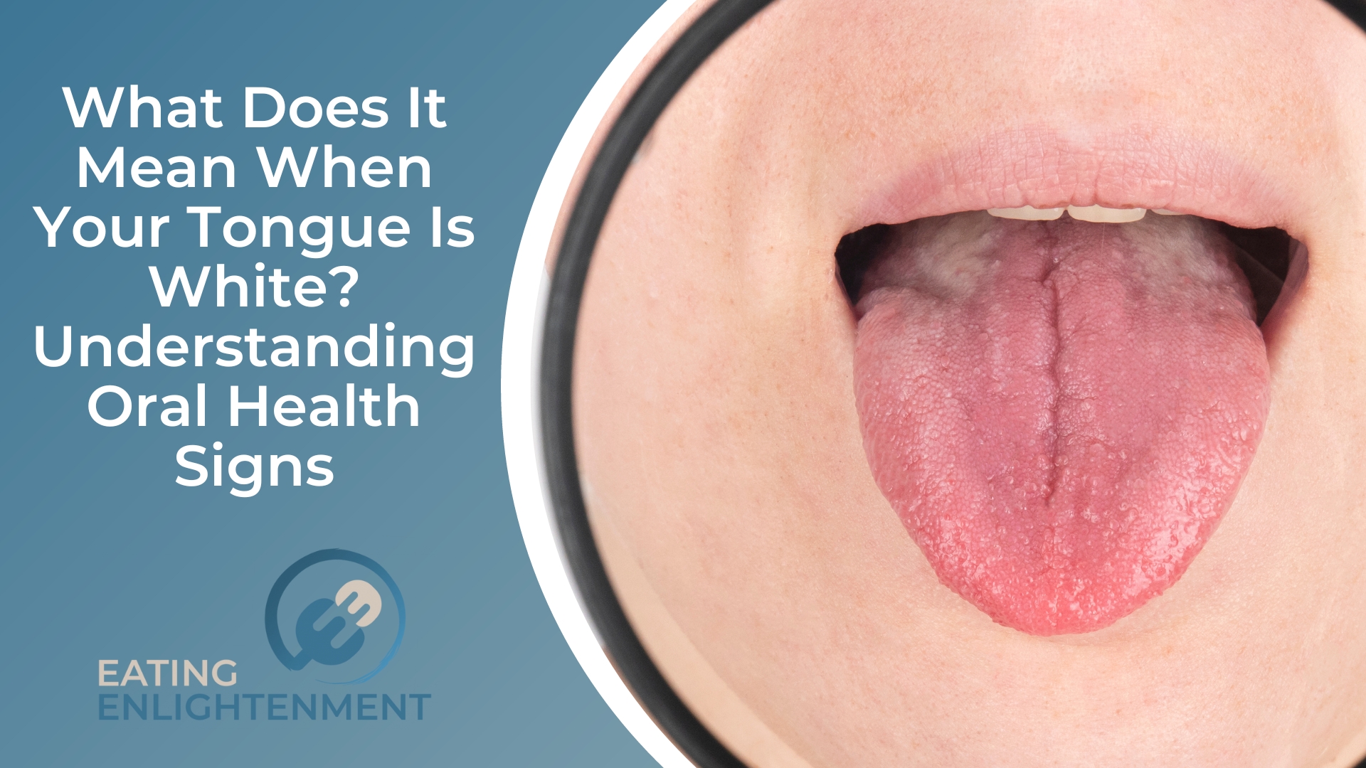 What Does It Mean When Your Tongue Is White Understanding Oral Health Signs