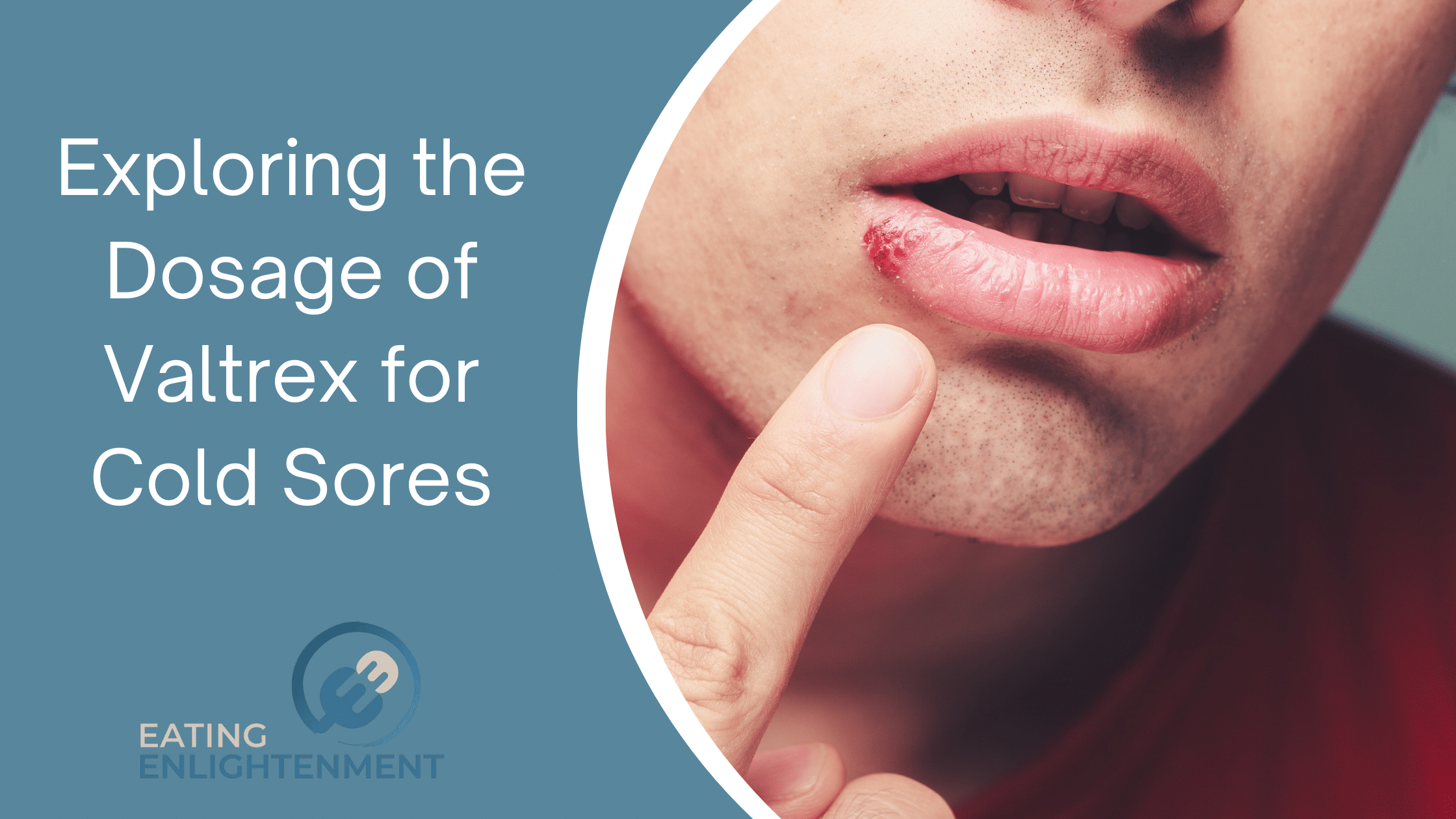 Exploring the Dosage of Valtrex for Cold Sores