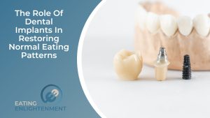 The Role Of Dental Implants In Restoring Normal Eating Patterns