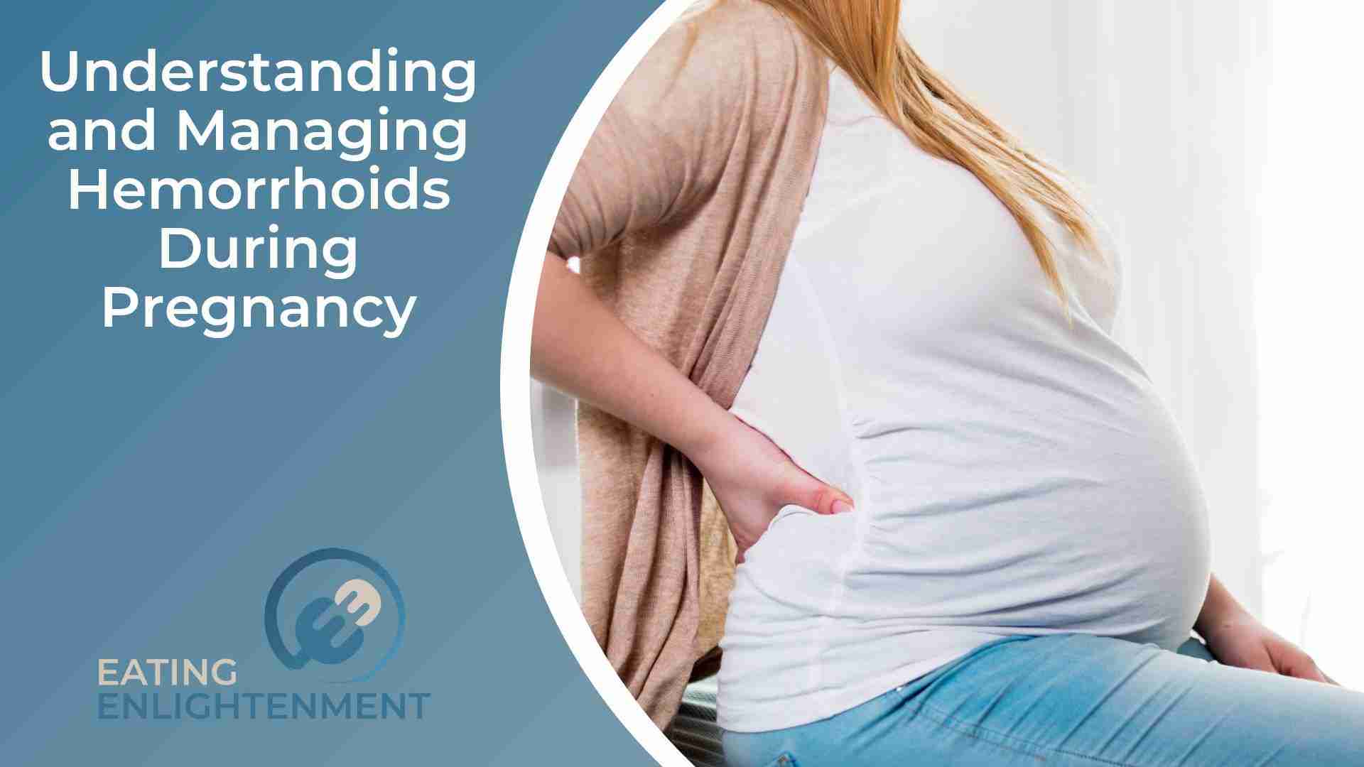 Understanding and Managing Hemorrhoids During Pregnancy